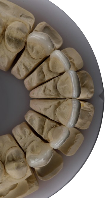 Porcelain Veneer and Smile Design Masterclass